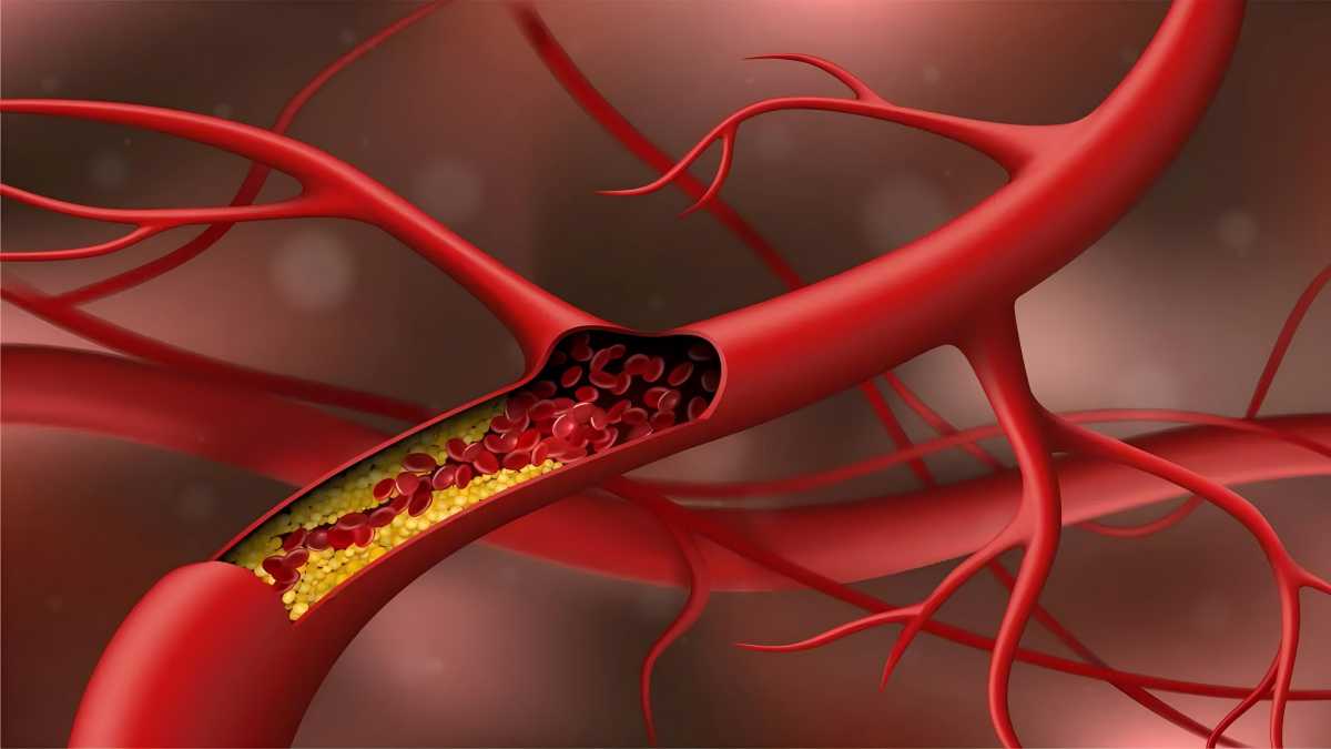 The Truth About Cholesterol: Myths vs. Facts